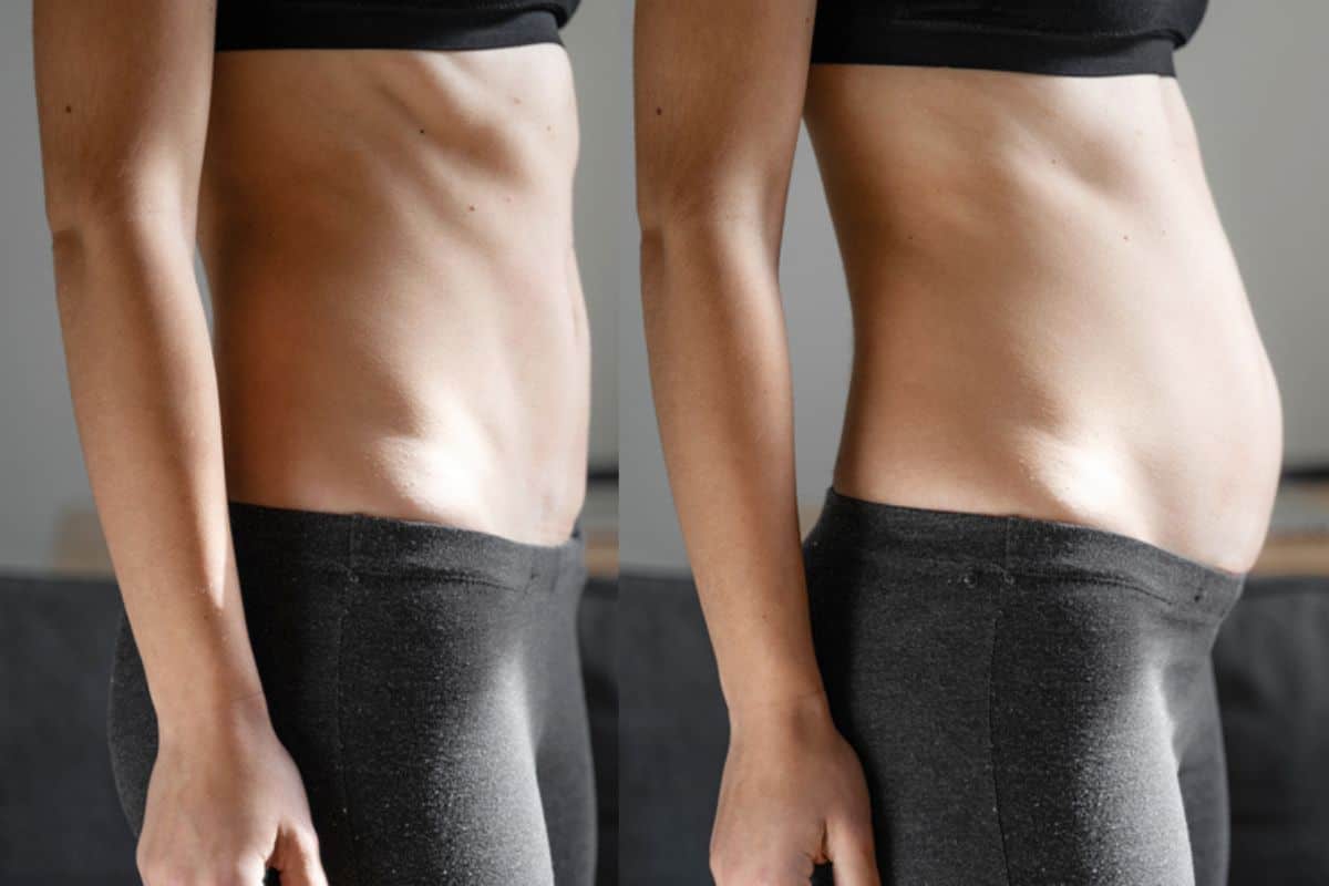 How long does diastasis recti take to improve Custom House?