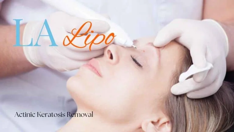 Woman receiving Actinic Keratosis Removal Treatment Custom House