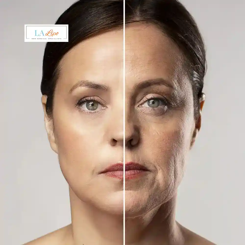 How Can You Tell If Non-Surgical Skin Tightening Is Right for You Custom House?