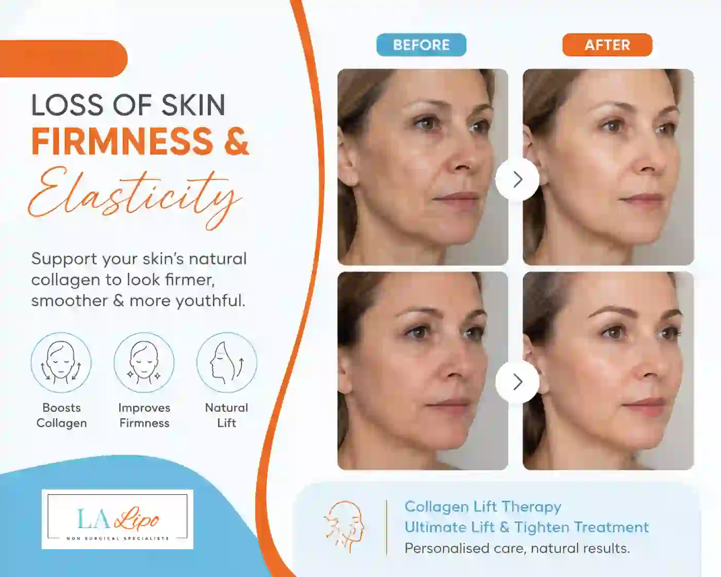 Sign #7: Loss of Skin Firmness and Elasticity Custom House