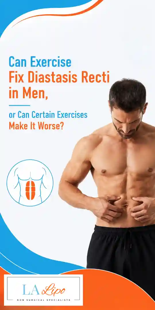 Can Exercise Fix Diastasis Recti in Men, or Can Certain Exercises Make It Worse Custom House?