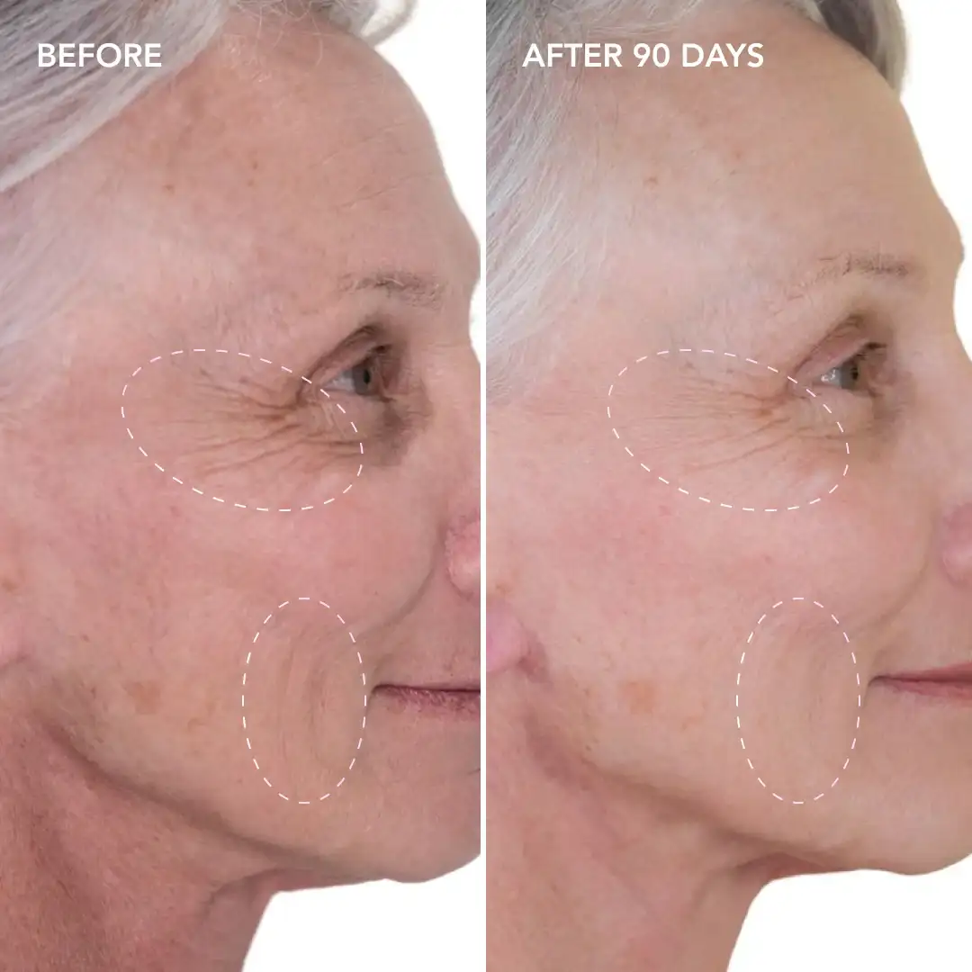 When will you see results Custom House